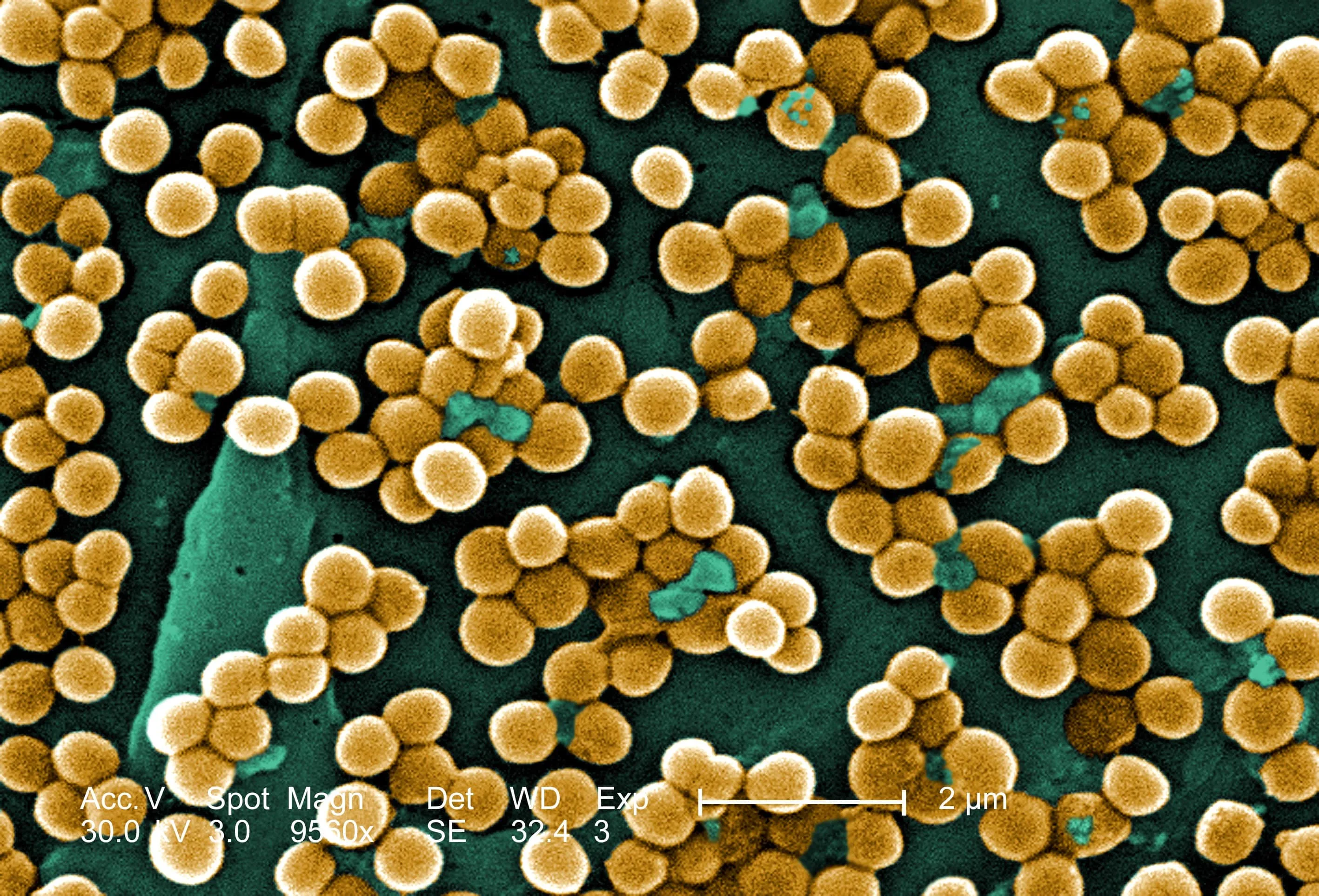 Closing the Net: Why European action on AMR is indispensable