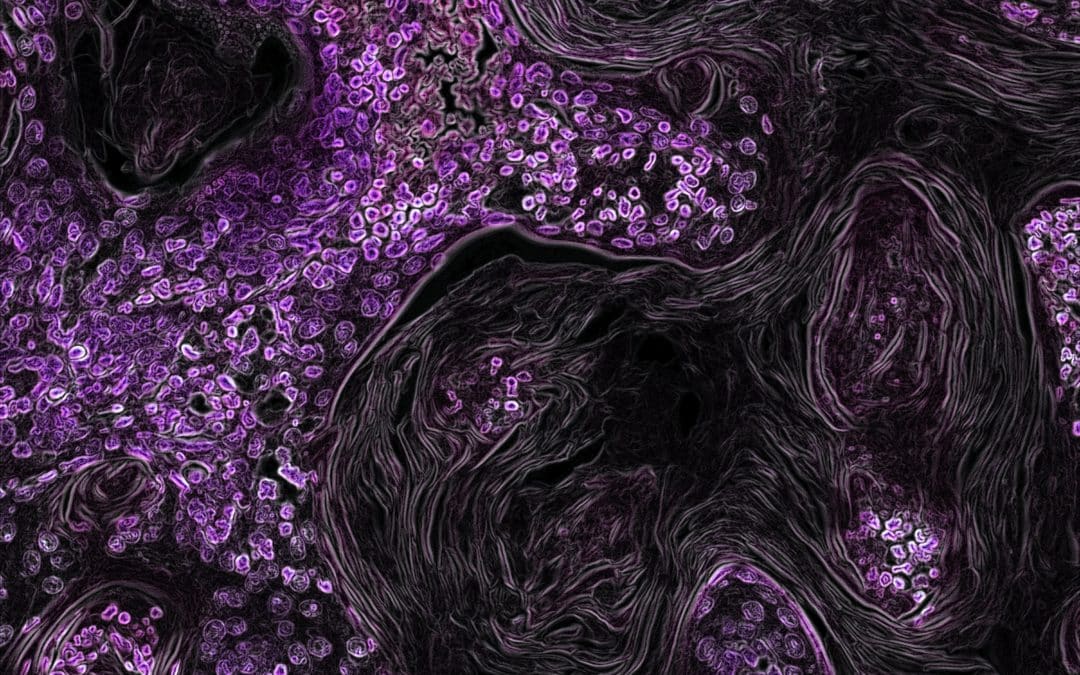 EPHA’s Response to the Roadmap for Europe’s Beating Cancer Plan