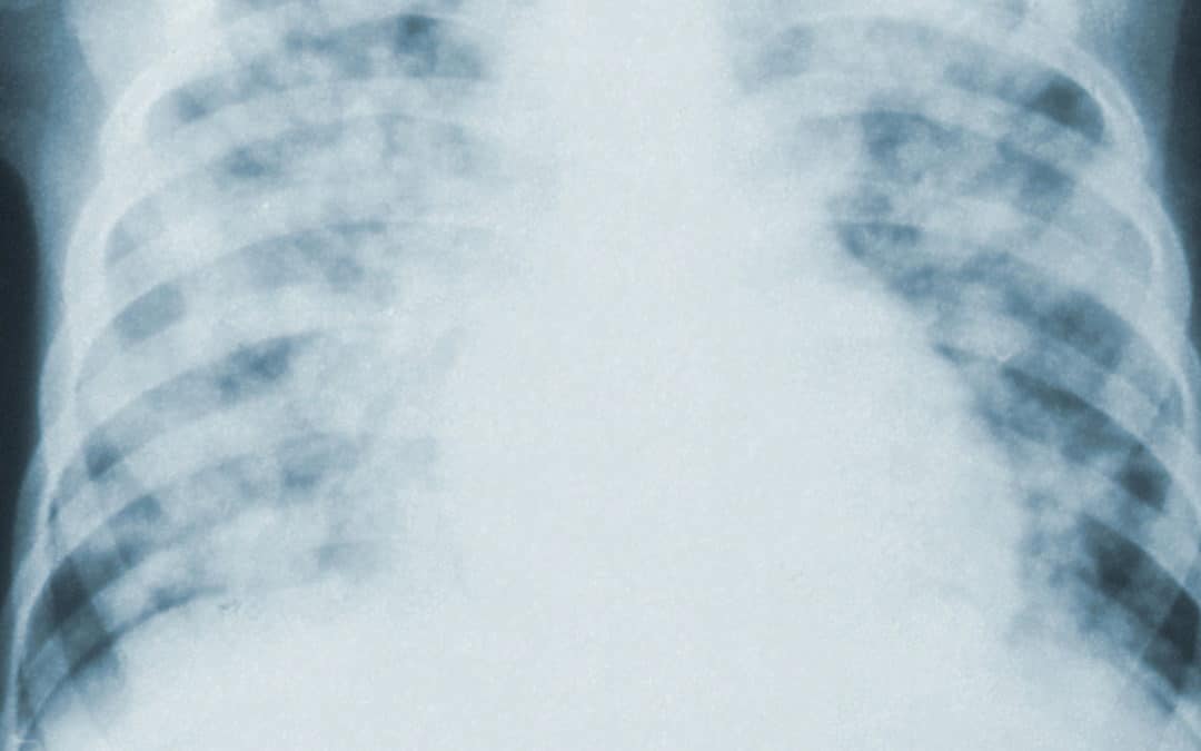 Air pollution caused conditions: the risk of co-morbidities