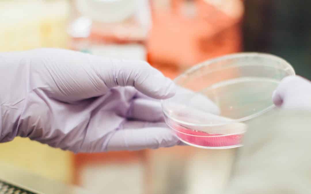 Time to fight AMR and improve transparency in the pharmaceutical industries