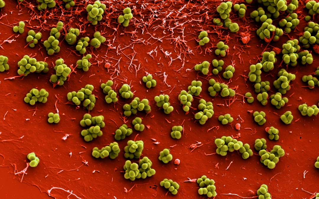 New tools for the shed: How we will fight infections in the future